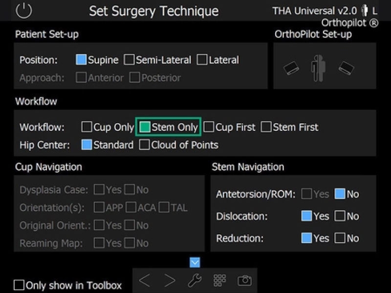 スクリーンショット Stem 股関節形成のナビゲーションソフトウェアのみ