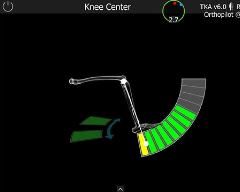 OrthoPilot® TKA ソフトウェアのスクリーンショット - ニーセンター