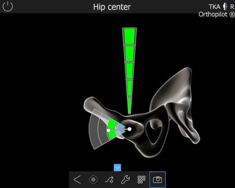 OrthoPilot® TKA ソフトウェアのスクリーンショット - 股関節中心