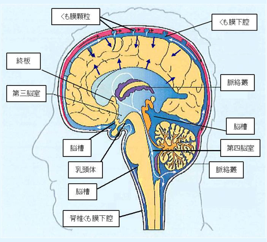 水頭症の特徴と症状 - B. Braun